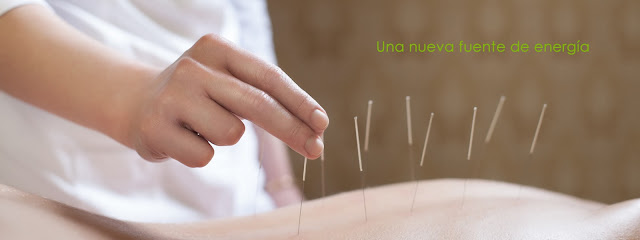 ISABEL LOIZU MARTI Acupuntura